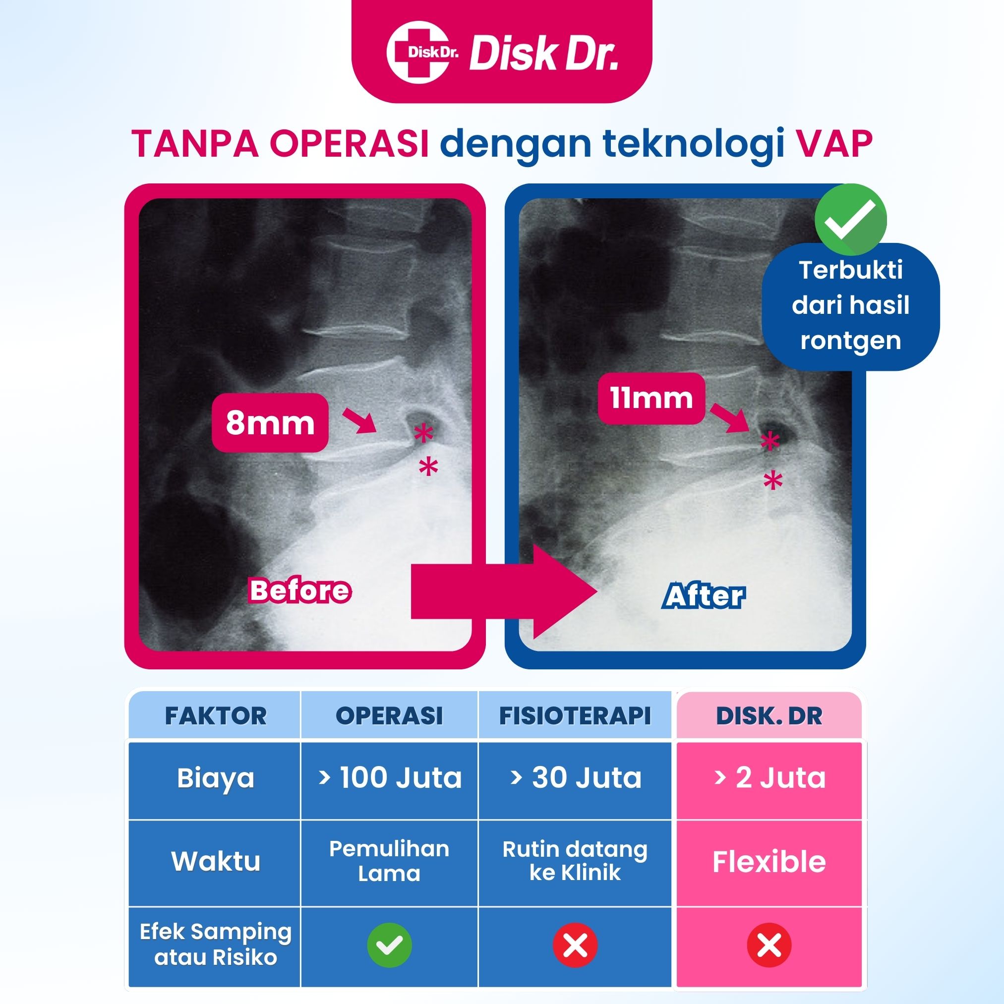 DDR WD57P G2 XL - Image 4