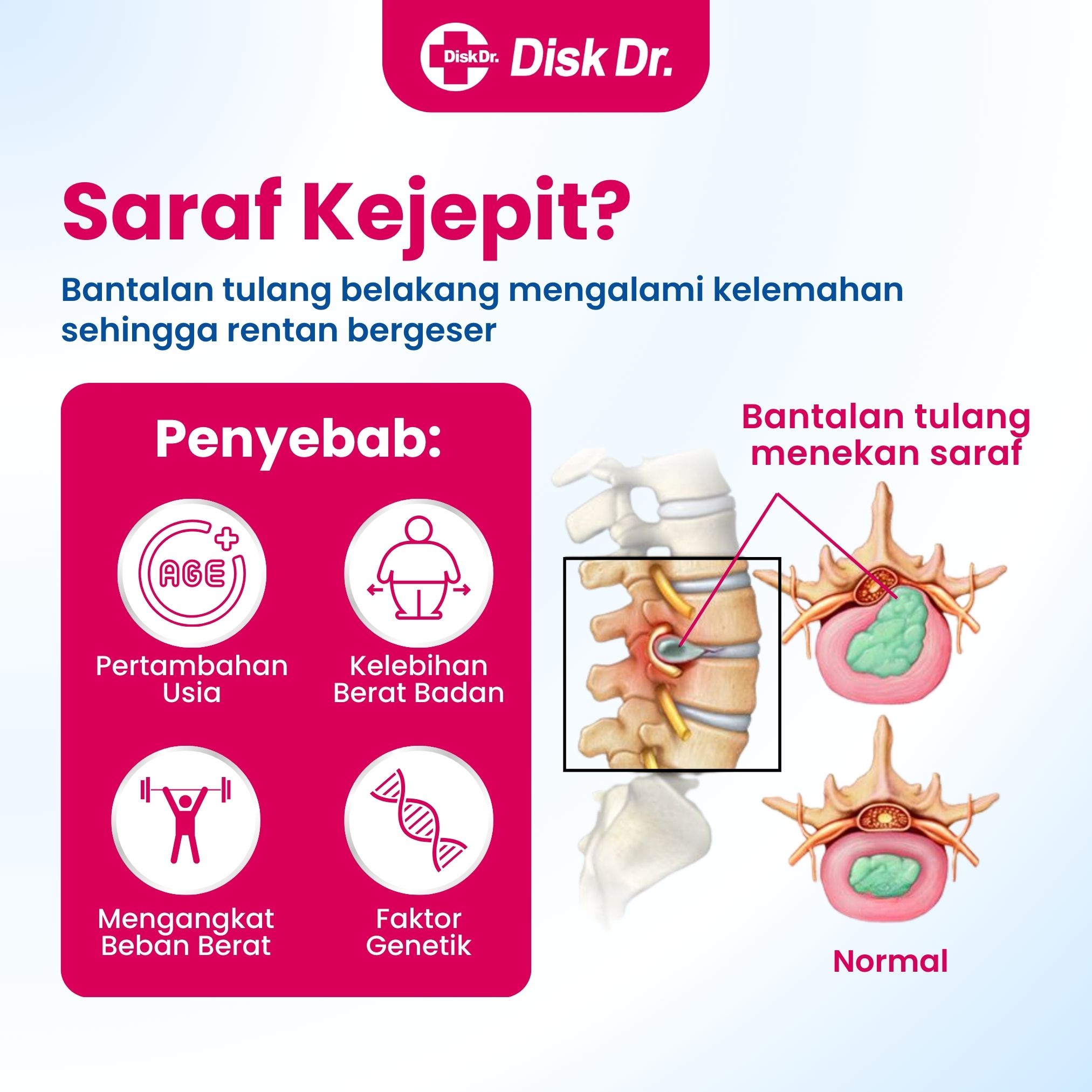 DDR WD57P G2 XL - Image 2